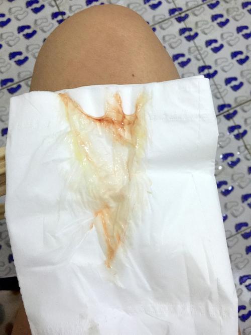 玉大大    2016-06-27 00:05 羊水破了是没有