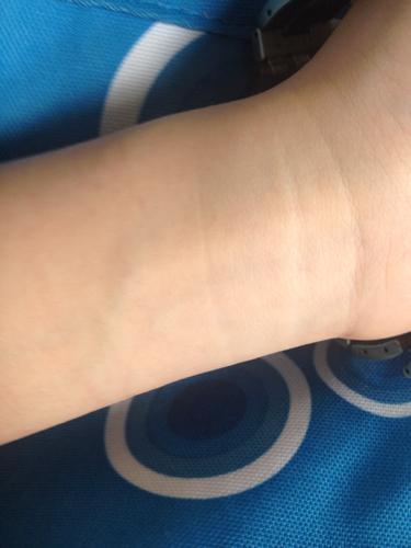 这是我左手手腕,第一幅图左边那根比较粗的血管是什么