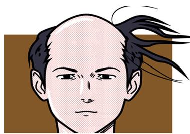 头顶脱发还能长出来吗 解读头顶脱发能治好吗