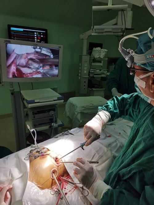 全胸腔镜微创心脏手术