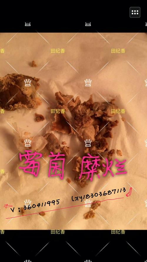 宫颈糜烂微创多少钱?值得反思!值得深思