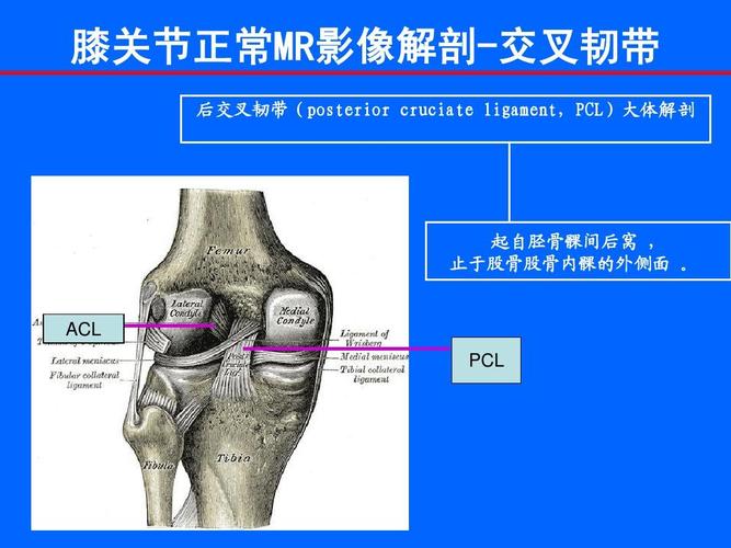 后交叉韧带(posterior cruciate ligament,pcl)大体解剖 起自胫骨髁间