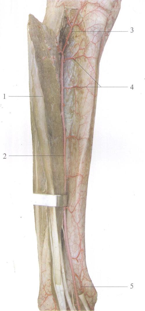 图4-130 胫前动脉