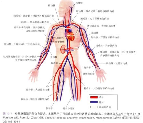 思维导图首次上肢动静脉内瘘术前血管条件评估