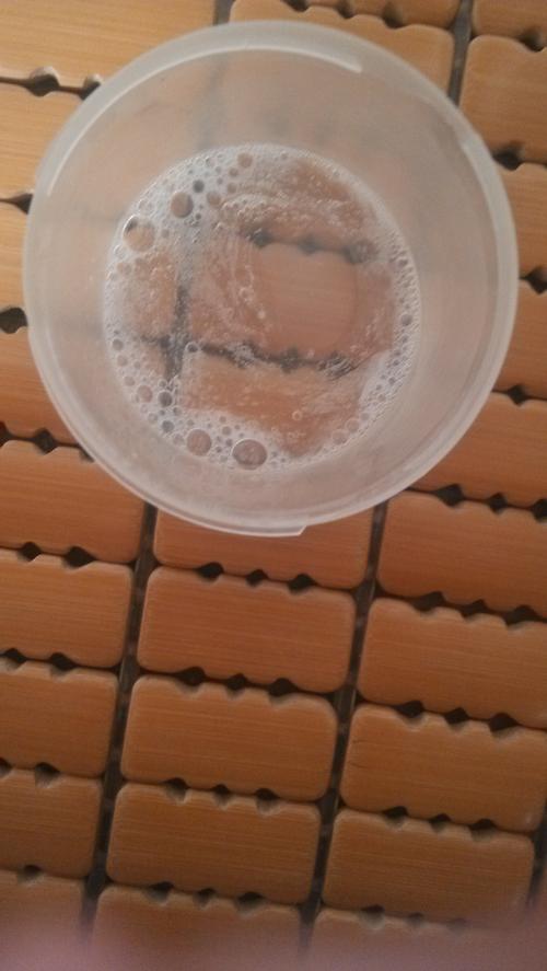 我可能患上肺结核,要检痰,但是以下图片里带痰吗?