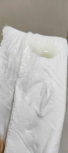 白带酸奶稠浆糊状 一年了 啊啊啊 崩溃