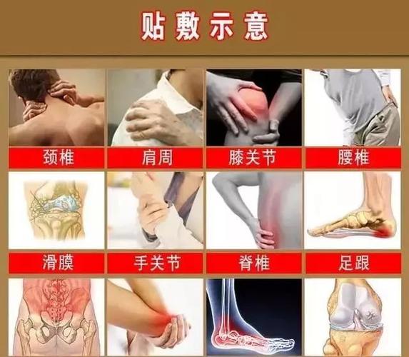 常见膏药贴敷处