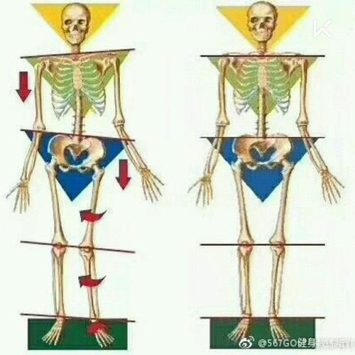 骨盆歪斜之后,肌肉肯定是失