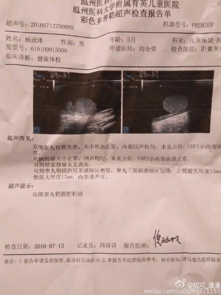 宝宝阴囊不一样大,医生让做个阴囊b超如图,之前孩子有疝气,有两个月