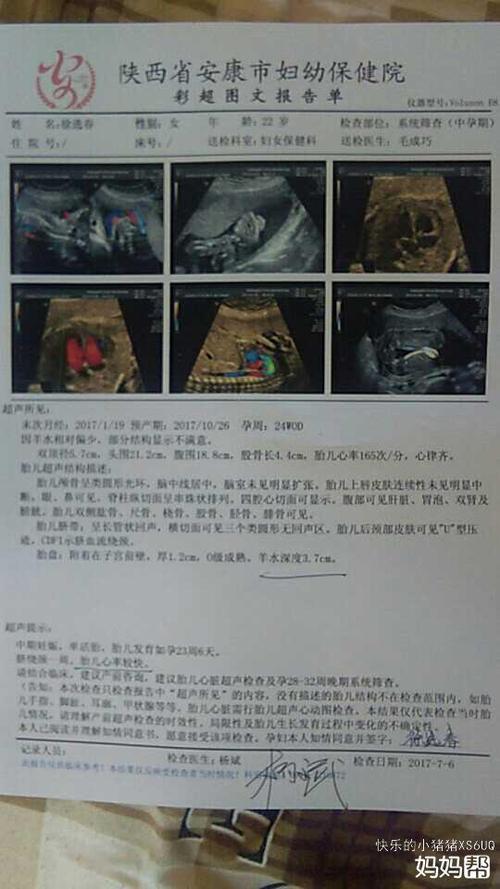 正能量来袭开放性神经管畸形高风险四维顺利通过