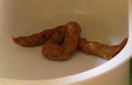 这坨屎是1岁小孩拉的,猜猜是男孩子拉的还是女孩子拉的.说明理由.