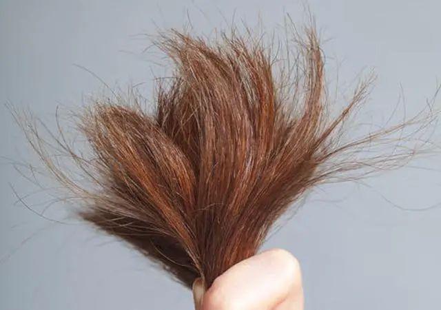 头发枯黄分叉没在意这是对自身健康极其不负责的表现