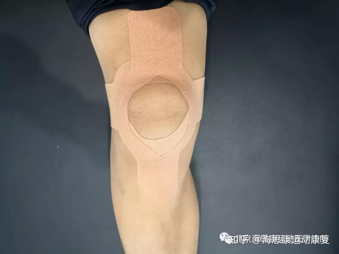 膝关节的物理外挂肌贴解密海思康运动医学诊所