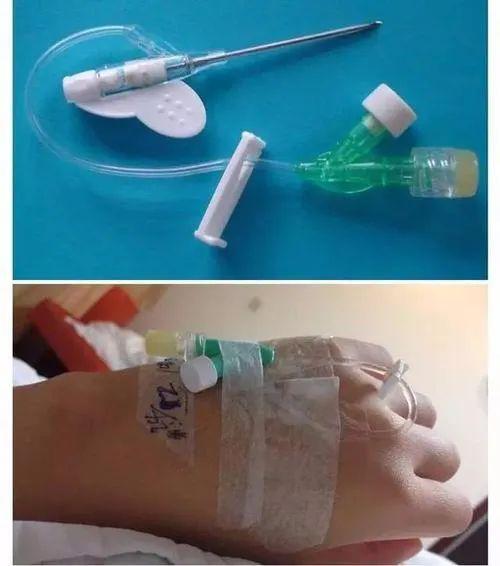 外周静脉留置针