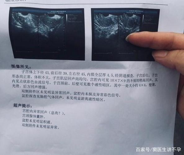 排卵期出血了,还能同房吗?