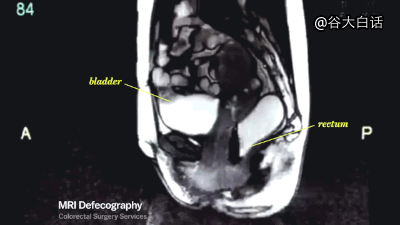 mri下诡异而奇妙的人体|核磁共振|猎奇|搞笑_新浪新闻