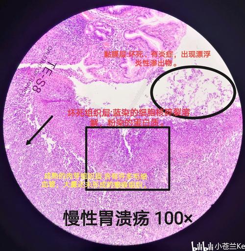 病理学实验切片
