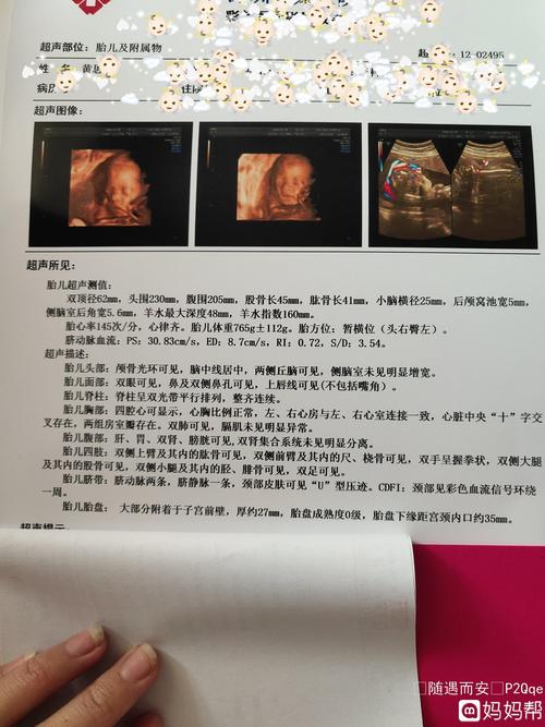 今天刚做四维彩超,好好清楚提前看到自己小宝贝,不知道男孩女孩