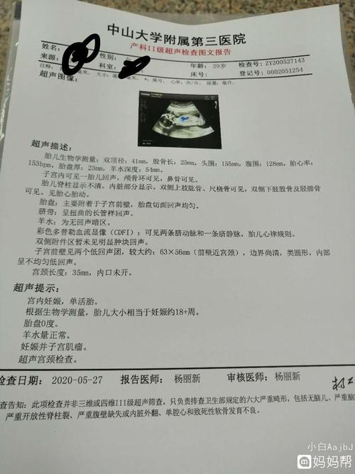 18周b超图看的像女宝宝