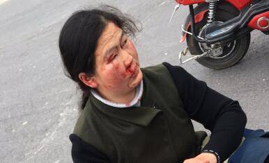 急急!速转:李口高速口女子撞上公交,头部出血,急寻家人!