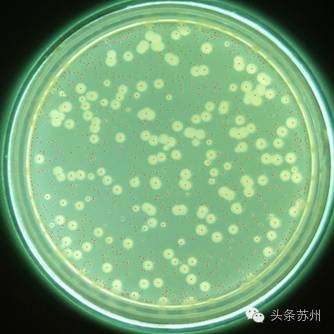 海产品常带有什么细菌答:葡萄球菌致病性大肠埃希氏菌变形杆菌沙门氏