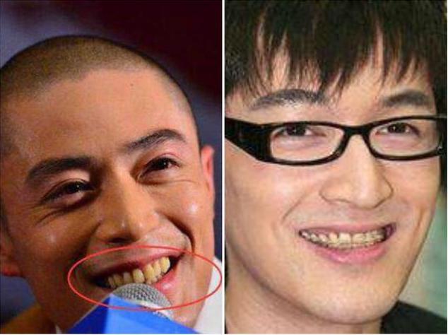 高伟光的牙齿比演技火上热搜全靠一口大白牙网友确实白