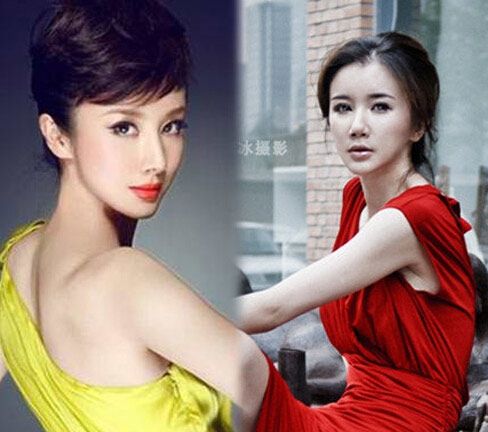 孙菲菲整容失败变僵尸脸 整容前后变化吓人