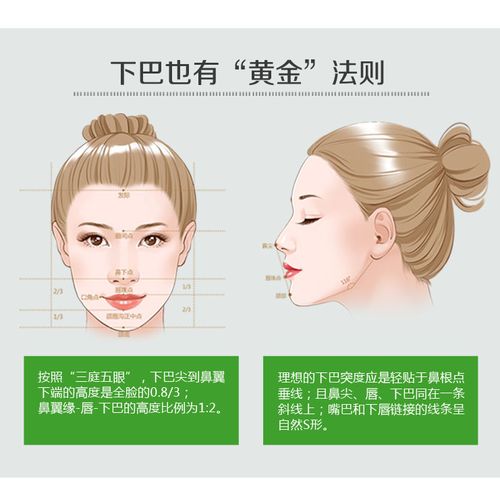 沈阳下颌角手术 塑造立体轮廓 v字小脸