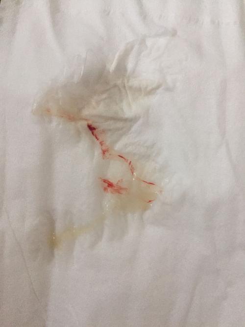 白带带血 腰痛腹胀腹泻