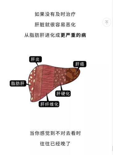 怎么样才能把脂肪肝给吃回去呢?做到这五点你就能成功!