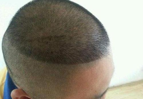 郭德纲发型是什么发型