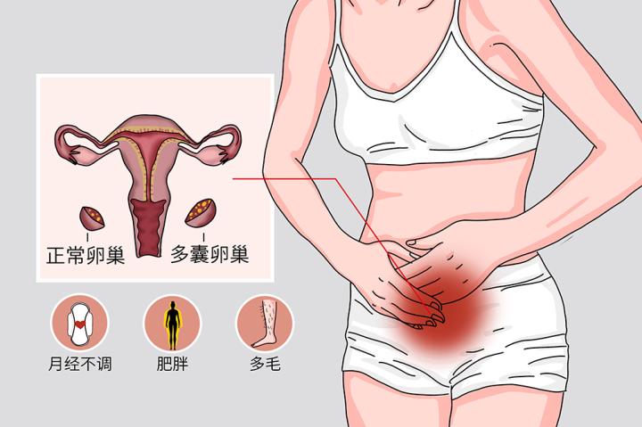 武汉妇科专家廉河清:肚子胀按左下腹有肿块,卵巢囊肿中医治疗效果好不