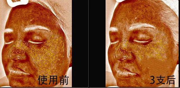 4 24小时补水保湿, 改善痘痘肌肤 除了强大的淡斑