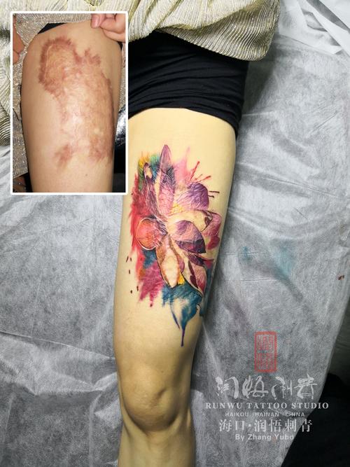大面积烫伤疤痕遮盖纹身