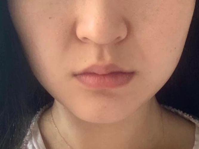 我鼻基底凹陷,连带着我的法令纹也特别的明显,即使是