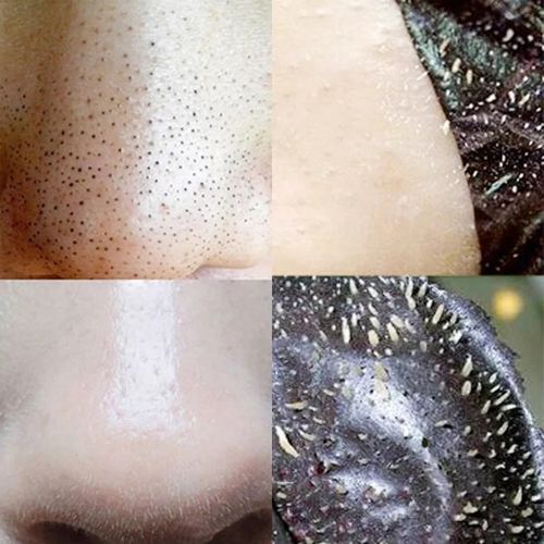 鼻头贴全脸去黑头面膜撕拉式男女鼻膜膏脸部鼻子去黑头神器祛粉刺