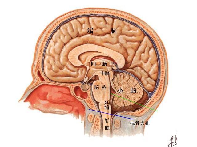 什么叫做脊髓延髓肌萎缩症导致患上该病是什么有何临床表现
