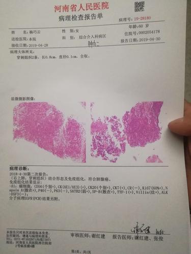 病理报告-肺癌康复圈-觅健