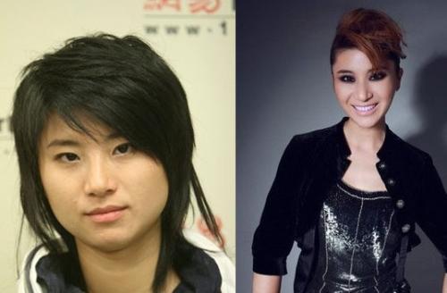 前快女整容成畸形锥子脸 选秀歌手疑整容