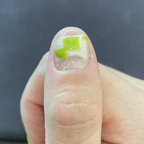 一做指甲就会和甲床分离