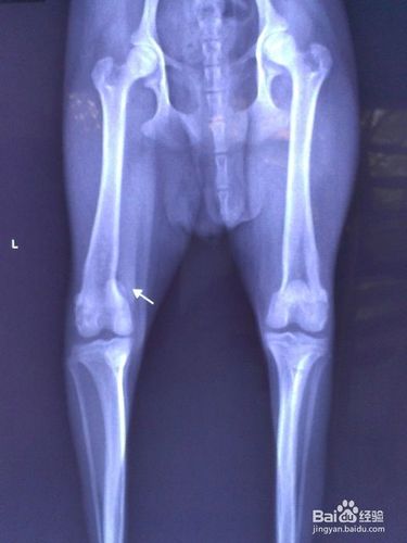 5  宠物医生如果怀疑髌骨脱位,除了做一般体检外,还会给爱犬拍个x光