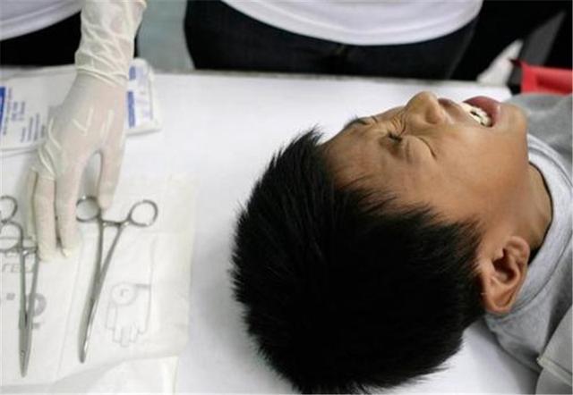 菲律宾男性"割礼",通过了才算男人,现场一片"哀嚎"