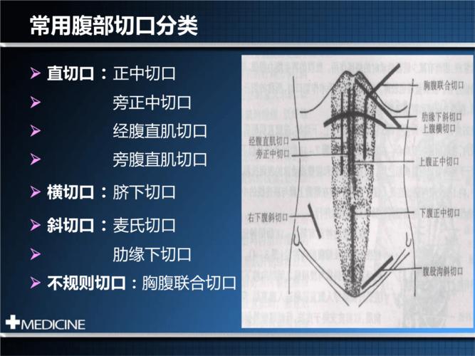 外科学-腹部常用手术切口.pptx 16页