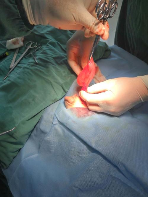 孩子的"蛋蛋"一下子就减轻了许多