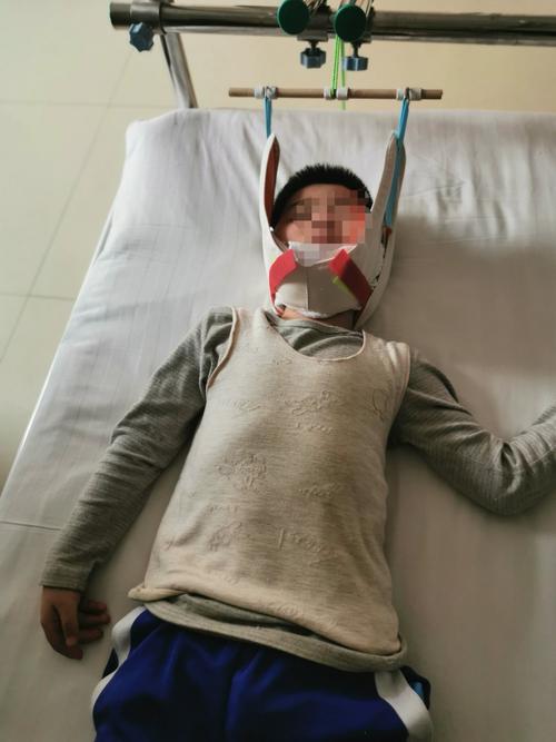 小儿寰枢椎半脱位,你了解吗?