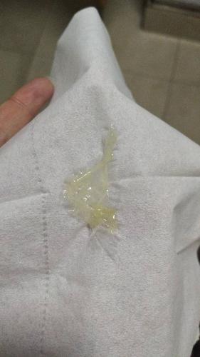 这个白带的颜色正常吗?