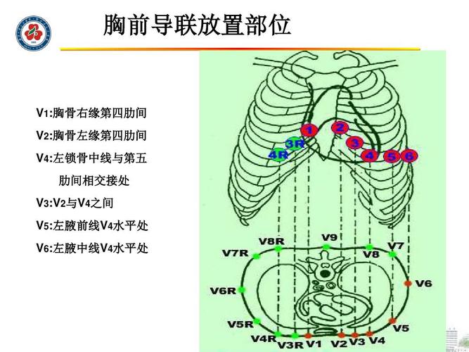 无忧文档 所有分类 医药卫生 临床医学 心电图ppt  胸前导联放置部位