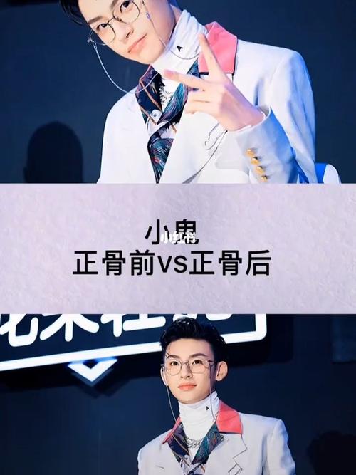 小鬼正骨前vs正骨后_娱乐_综艺片段