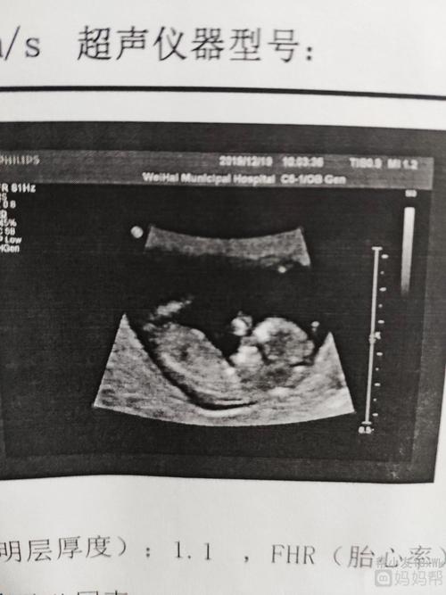 nt照片,能看出男女吗?