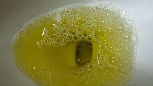 尿液很黄,还有一股异味,是咋回事?